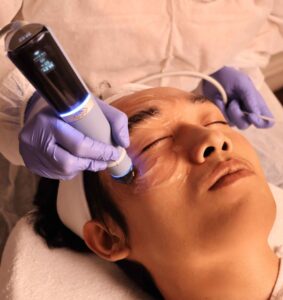 Solusi Non-Invasif untuk Pengencangan Kulit  & Anti-Penuaan (Skin Tightening & Anti-Aging)di Nurtura Aesthetic & Wellness